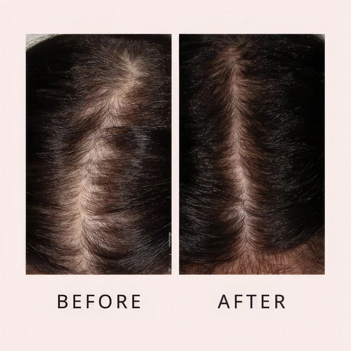Hair Growth Serum