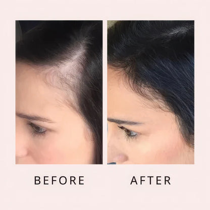 Hair Growth Serum