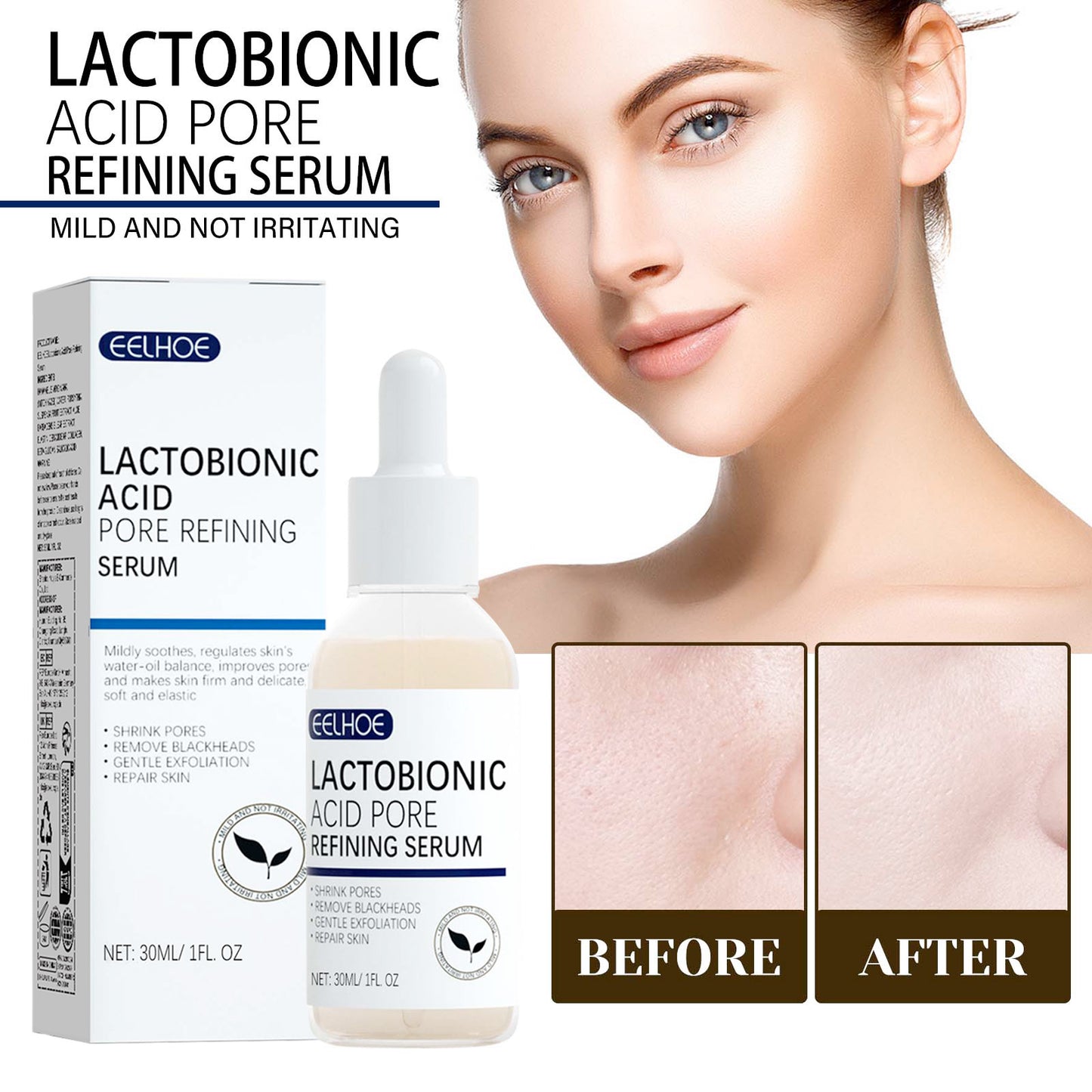 Lactose Acid Serum