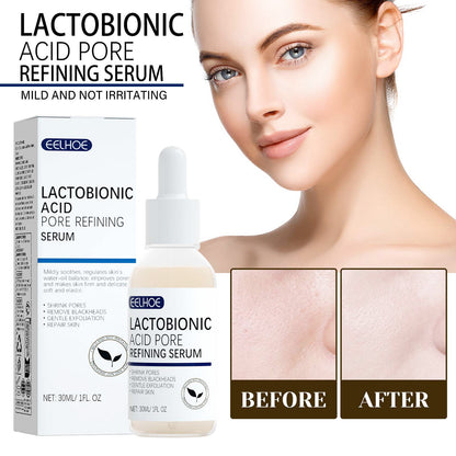 Lactose Acid Serum